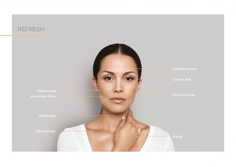 ultherapy skin tightening 