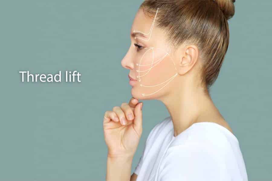 Thread lifting Treatment